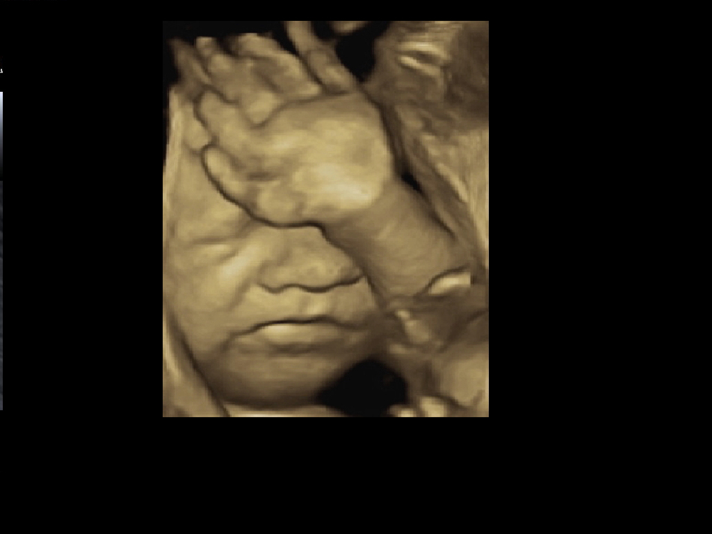 Les échographies 3D ou 4D — free download